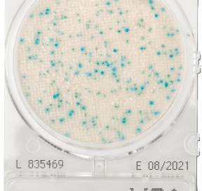 CompactDry X-SA Staphylococcus Aureus – Shimadzu